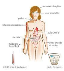 Les bouffées de chaleur traitées ici sont celles qui surviennent lors de la pré ménopause et de la ménopause, périodes où, fréquemment, les en médecine traditionnelle chinoise, les bouffées de chaleur sont considérées comme des symptômes naturels chez la femme atteignant la ménopause. Hyperthyroidie Les Symptomes De L Hyperthyroidie