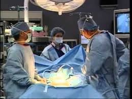 I Had A Full Hysterectomy At The Age Of 50 Nine Years After Having A Laparoscopy To Remove Endometriosis Here Hysterectomy Robotic Surgery Unitypoint Health