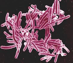 Mycobacterium Tuberculosis Bacteria The Cause Of Tb Microbiology Tuberculosis Disease