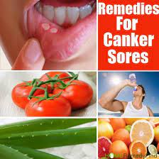 Pin On Home Remedies