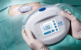 We did not find results for: Negative Pressure Wound Therapy Market Size Is Anticipated To Touch Usd 2 24 Bn Till 2023 Driven By Mrfr Medgadget