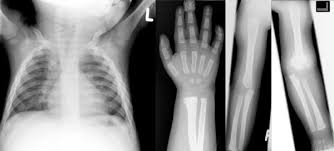 Da danke, aber dort war ich schon. Pedirad