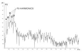 Perceptual adjustment to highly compressed speech: Using Deep Neural Networks For Smoothing Pitch Profiles In Connected Speech