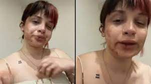 Sosyal medya fenomeni başak ermiş, oyuncu erkek arkadaşı can topçu tarafından darp edildi. 44cjc8jw9h1d M