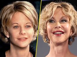 Photos : Meg Ryan : ravagée par la chirurgie esthétique !