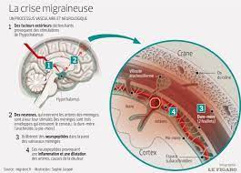 Petite précision, puisque je me suis rendue compte que tout le long de la vidéo je dis que les femmes arretent de prendre la pilule parce qu'elles ont peur. A Quoi Sont Dues Les Migraines