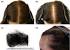 Iron Deficiency Hair Texture