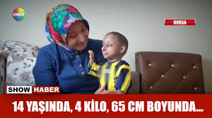14 Yasinda 4 Kilo Agirliginda 65 Cm Boyunda Youtube