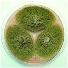 Choose a download type download time. Vladimir Ostry Head Of Nrc For Microfungi And Mycotoxins Dvm Phd Assoc Prof Statni Zdravotni Ustav Prague Szu Centrum Zdravi Vyzivy A Potravin
