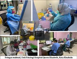 Sebelum hospital queen elizabeth dibina pada tahun 1957, hospital yang lama yang digunakan di kota kinabalu adalah hospital jesselton. Malaria Cases Down 43 In Sabah
