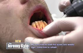 These pot scrubbers consist of steel wool mixed with soap, giving everyone a one stop solution for scrubbing. Jeremy Kyle Guest With Teeth Like Brillo Pads Tried To Stab His Sister While High On Crack Cocaine