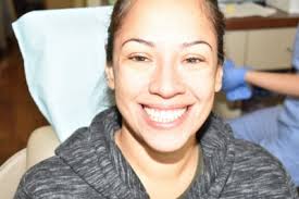 Why It's Never Too Late for Adult Braces