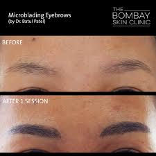 Here's how to figure out which eyebrow tattoos are best for microblading's recent popularity has spawned microshading and microfeathering, two techniques that give you a different brow look depending on. Microblading Eyebrows Dr Batul Patel