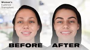 En cuanto a las cejas en las mujeres, ¿te va más que sean más gruesas, o  prefieres las finas? : r/fixedeyebrows