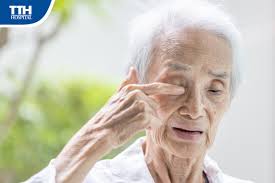 Thoái hóa điểm vàng: Nguyên nhân hàng đầu gây mù lòa