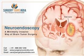 Neuroendoscopy A Minimally Invasive Way Of Brain Tumor Surgery Brain Tumor Tumor Surgery