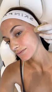Come with me to @skin_pharm to try a Gold Infusion facial — a gentle  stamping treatment that boosts collagen, hydrates and brightens skin ✨🤍🫧,  -, -, #glowyskin #skincare #skintreatment #skinpharm ...