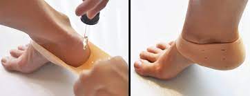 Emuaid.com has been visited by 100k+ users in the past month Deep Heel Itching What Causes It And How To Heal It
