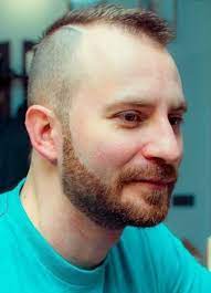 15 Best Hairstyles For Balding Men Askhairstyles Kapsel Man Mannenhaar Kapsels Voor Kalende Mannen