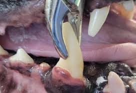 Image result for Tooth Extraction