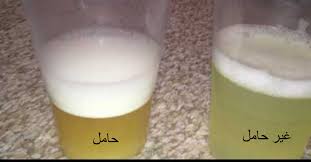كيفية معرفة الحمل اختبارات الحمل الصحيحه بمكونات طبيعيه من البيت دلع ورد