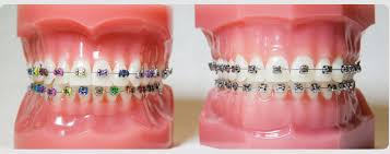 Image result for orthodontist