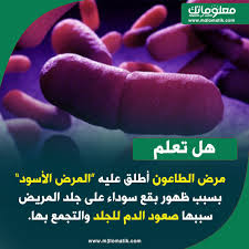هل تعلم مرض الطاعون Pill Convenience Store Products Convenience Store