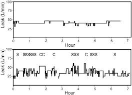 Leak Profile Inspection During Nasal Continuous Positive