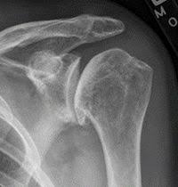 X Rays Physiopedia