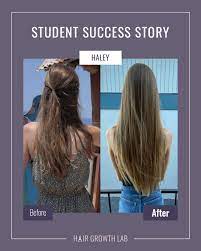 We can totally connect with you. 1 Year Hair Journey Hair Growth Lab