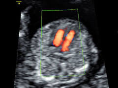 Als entscheidungshilfe für werdende eltern plant der. Zentrum Fur Pranataldiagnostik Und Humangenetik Kudamm 199