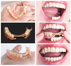 With Removable Valplast Partial Dentures Your Smile Is Complete Again Proper Oral Hygiene Practices Are Necessary Partial Dentures Dentures Dental Cosmetics