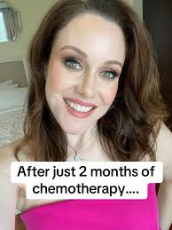 Lauren Oconnell Survivor Transformation