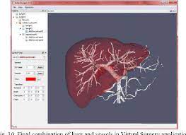 There are 2 distinct sources that supply blood to the liver, including the following: Figure 10 From Automatic Slice Growing Method Based 3d Reconstruction Of Liver With Its Vessels Semantic Scholar