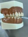 千代田区市ヶ谷の歯医者としてインプラント矯正歯科ホワイトニングについて