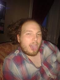 The Baldy Hair growth Challenge