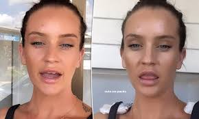 His right upper arm contains a tattoo of a cross with scales of balance hanging from both sides of the cross. Mafs Star Ines Basic Is Removing Her Shoulder Tattoos After Claiming She Is Broken Daily Mail Online