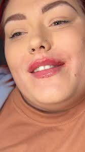 1.1ml Advanced/Russian Lips 🤍