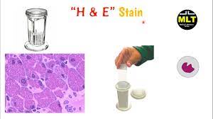 Hematoxylin & eosin (h & e) stain protocol principle: H And E Staining Procedure Histopathology H And E Staining In Hindi Youtube