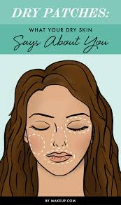 Dry Patches What Your Dry Skin Says About You Makeup Com By L Oreal Dry Skin Makeup Dry Skin Patches Dry Skin On Face