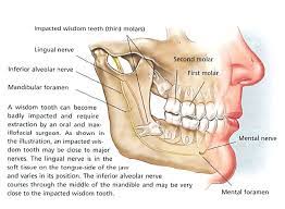 Wisdom Teeth Also Called Third Molars Usually Do Not Push Through The Gums Until People In Their Late Wisdom Teeth Impacted Wisdom Teeth Wisdom Teeth Removal