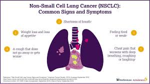 The actual diagnosis of lung cancer is made by looking at a sample of lung cells in the lab. Astrazeneca On Twitter The Majority Of Patients With Non Small Cell Lung Cancer Nsclc Have Already Reached An Advanced Stage When They Are Diagnosed Do You Know The Signs Of Nsclc Https T Co V5vimti34a