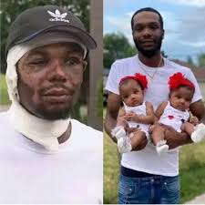 I gave out my looks to save the life of my adorable twin girls. I didn't  care whether I died or lived,they were worth it.Despite the transformation 