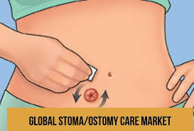 Global Stoma Ostomy Care Market By Top Leading Key Players