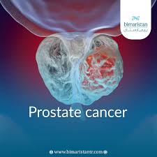 Image result for Prostate Cancer