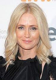 Kelly Rowan Plastic Surgery Before And After Celebrity Surgeries Celebrity Surgery Plastic Surgery Celebrity Plastic Surgery