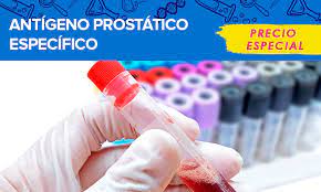 Consulte a su médico, es el único facultado para indicar el tipo de estudio de laboratorio a realizar en cada paciente de acuerdo a su historia clínica e interpretar los resultados. Antigeno Prostatico Especifico Jenner