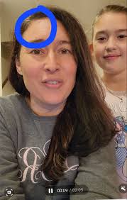 It's just a wisdom spot." — Laura Rice Ownby