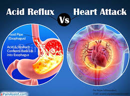 All she knew was that it felt a bit like someone was sitting on her chest. Can Acid Reflux Feel Like A Heart Attack Acid Reflux Vs Heart Attack
