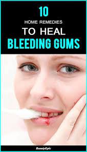 How To Treat Bleeding Gums 10 Home Remedies To Try Bleeding Gum Gum Disease Gum Health